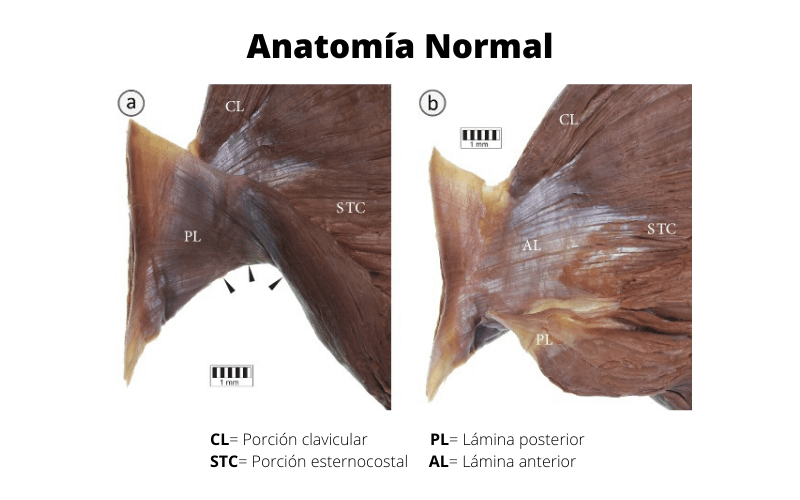 Anatomia Normal A.png